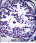 RAB5C Antibody (C-term)